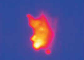Thermal image sample 3